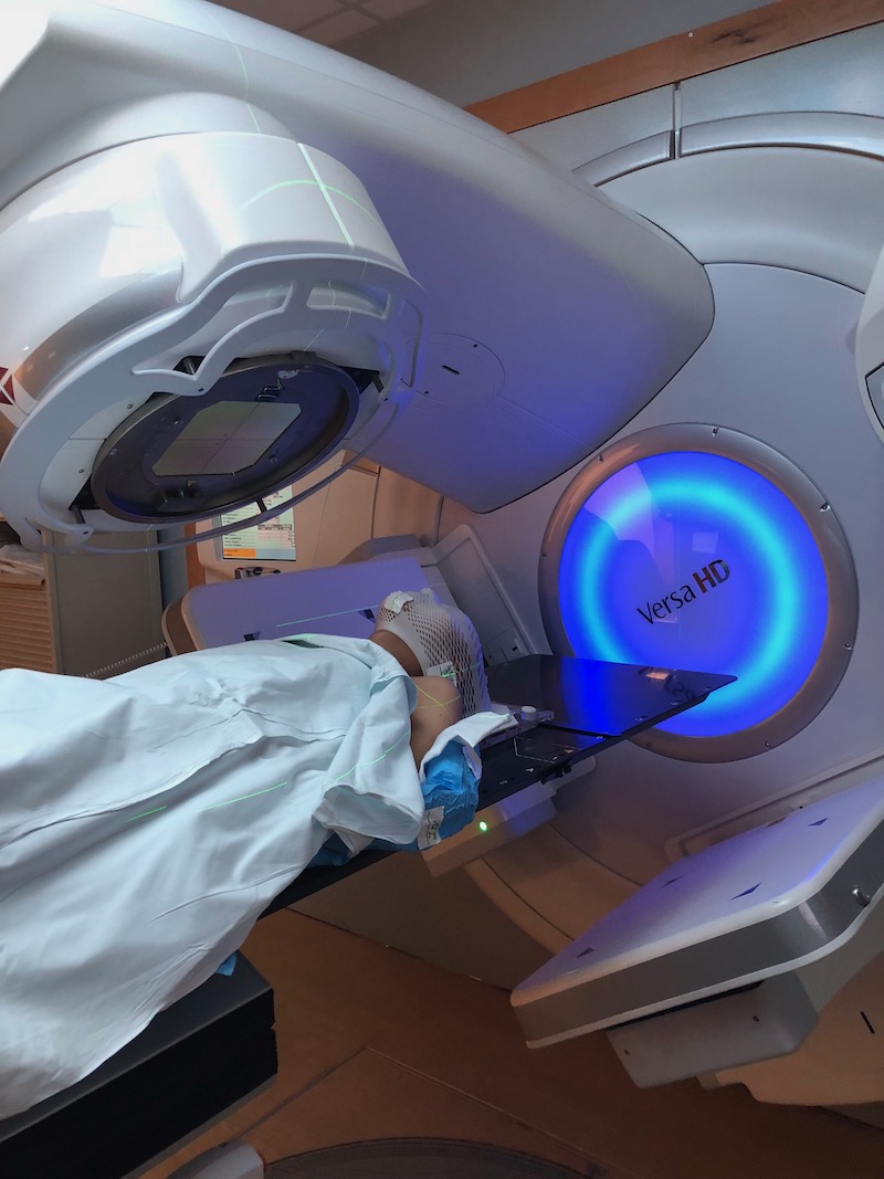 Figure 1: Radiation therapy for cancer.